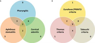 Challenges in the diagnosis of periodic fever, aphthous stomatitis, pharyngitis, and adenitis syndrome in developing countries—A decade of experience from North India